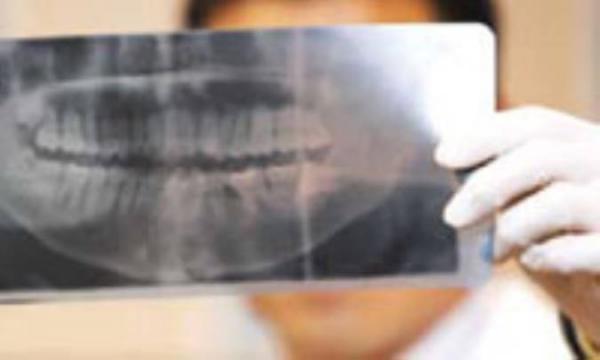 آنچه دندانپزشکان از رادیولوژی باید بدانند